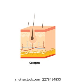 Hair follicle in anagen phase shown in skin cross-section. Hair growth cycle medical educational poster. Removal, treatment and transplantation concept. Vector illustration.