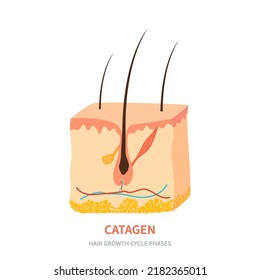 Hair Follicle In Catagen Phase Shown In Skin Cross-section. Hair Growth Cycle Medical Educational Poster. Removal, Treatment And Transplantation Concept. Vector Illustration.