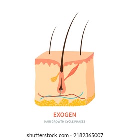 Hair follicle in exogen phase shown in skin cross-section. Hair growth cycle medical educational poster. Removal, treatment and transplantation concept. Vector illustration.