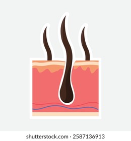 Hair Follicle Illustration. Vector illustration of hair follicles emerging from the skin, highlighting the structure and growth of hair