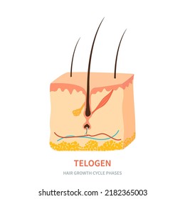 Hair Follicle In Telogen Phase Shown In Skin Cross-section. Hair Growth Cycle Medical Educational Poster. Removal, Treatment And Transplantation Concept. Vector Illustration.