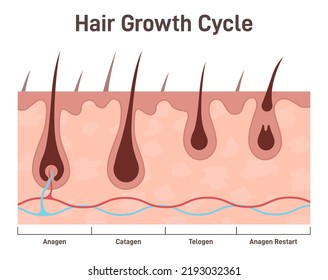 Hair growth cycle. Hair developing stages, anagen, telogen, catagen. Cross-section anatomical structure of skin with hair folicule. Flat vector illustration