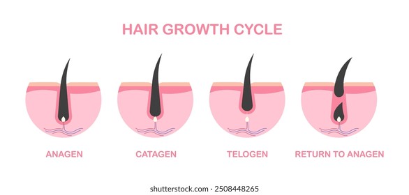 Ciclo de crescimento de cabelo de folículos diagrama de fase estrutura de raízes de cabelo. Fases de crescimento do cabelo: Anágeno - fase de crescimento, Catágeno - fase de transição, Telógeno - fase de repouso.