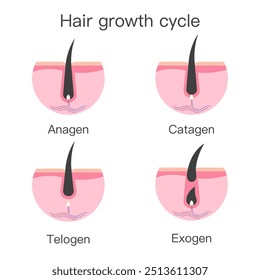 Wachstumszyklus der Haare. Das Haar wächst Stadien: Anagen - Wachstumsphase, Catagen - Übergangsphase, Telogen - Ruhephase, Exogen - Shedding - Phase.