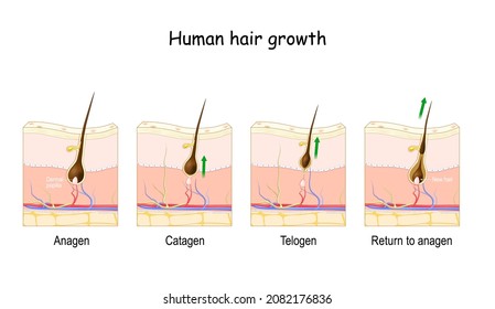 Hair growth cycle. Human skin. Follicle anatomy. Anatomical poster. Hair growth phase step by step. Stages from Anagen, and telogen, to catagen. Cross section of the skin layers. Medical vector