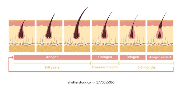 Hair growth cycle illustration. Anatomical diagram of development hair follicles from anagen telagen care papillae skin epidermis and health promoting stimulation vector growth hair cells.