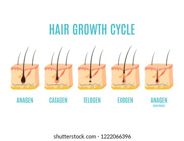 Hair growth cycle medical educational poster. Skin cross-section showing a hair follicle in anagen, telogen and catagen phases. Removal, treatment and transplantation concept. Vector illustration.