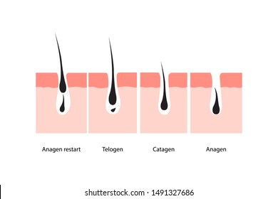 Hair Growth Cycle Skin. Vector Illustration