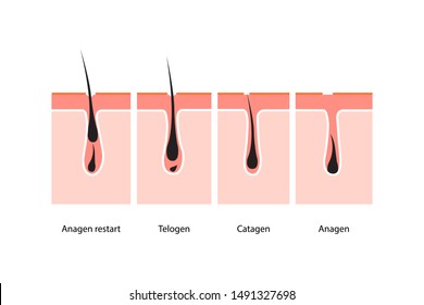 Hair growth cycle skin. vector illustration