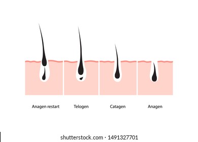 Hair growth cycle skin. vector illustration
