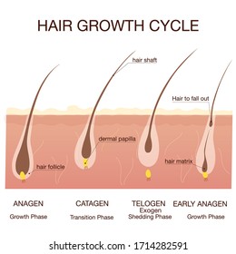  Hair growth phase step by step.Medical infographicsconcept.Stages of the hair growth cycle. Anagen, telogen, catagen. Hair human banner, anatomy