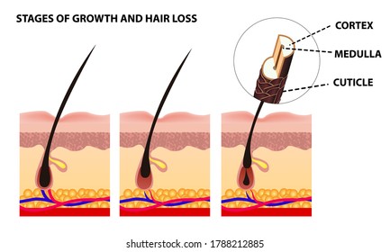 Hair growth phase step by step. Stages of the hair growth cycle. Anagen, telogen, catagen. Anatomy of the skin. Cross section of skin layers