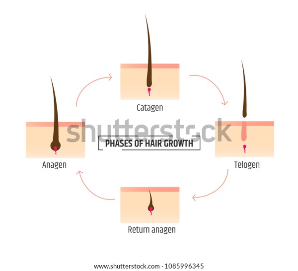 Hair Growth Phases Infographics Trichology Dermatology Stock Vector ...