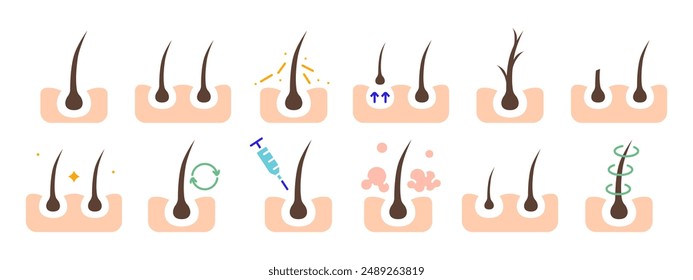 Hair growth set icon. Hair follicle stages, growth cycle, scalp care, injection, dermatology, treatment, hair loss prevention, hair health.
