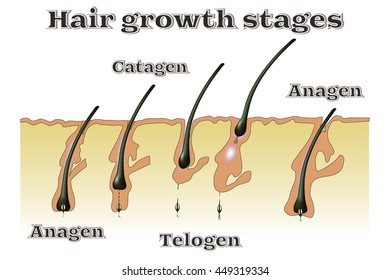 Hair Growth Stages Vector Illustration Stock Vector (Royalty Free ...