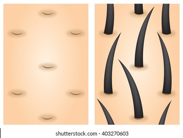 Hair Growth Stimulants Before After Vector .  Bald And  Healthy