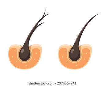 Hair Healthy and Split Ends Problem Cartoon illustration Vector