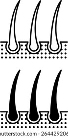 Hair Icons. Black and White Vector Illustration. Hair Bulbs, Human Body Part. Concept Anatomy