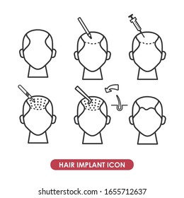 Hair Implant Line Icon. Health Care Symbol.