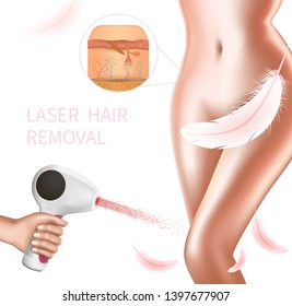 Hair Laser Removal Procedure on Female Intimate Area. Medical Beauty Spa Clinic Infographics, Cross Section of Depilated Dermis. Perfect Smooth Skin. 3D Vector Realistic Illustration, Square Banner