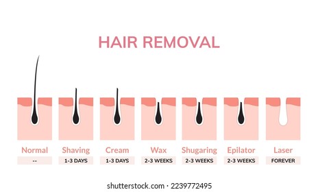 Hair laser removal treatment skin vector illustration bikini cosmetic light medical surgery woman armpit laser hair removal