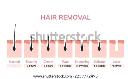 Hair laser removal treatment skin vector illustration bikini cosmetic light medical surgery woman armpit laser hair removal