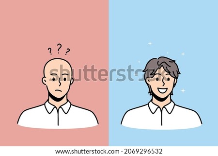 Hair loss and baldness concept. Faces of young completely bald man with frustrated mood and happy smiling hairy person vector illustration