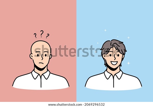 Hair loss and baldness concept. Faces of\
young completely bald man with frustrated mood and happy smiling\
hairy person vector\
illustration