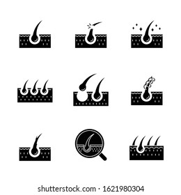 Hair loss black glyph icons set on white space. Damaged hair, unhealthy roots. Scalp and follicle. Skin tissue. Alopecia and balding. Silhouette symbols. Vector isolated illustration