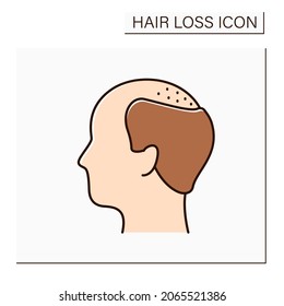 Hair loss color icon. Man loses hair. Male pattern baldness. Large bald area on frontal and central scalp. Alopecia concept. Isolated vector illustration