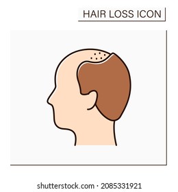 Hair loss color icon. Man loses hair. Male pattern baldness. Large bald area on front of scalp.Alopecia concept. Isolated vector illustration