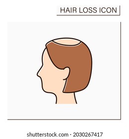 Hair Loss Color Icon. Woman Loses Hair. Widening Of Midline Part And Noticeably Decreased Hair Volume In Vertex. Alopecia Concept. Isolated Vector Illustration