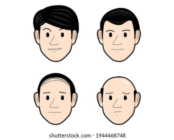 
Hair loss. Graph of four stages of alopecia