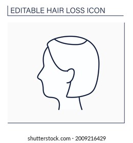 Hair Loss Line Icon. Woman Loses Hair. Widening Of Midline Part And Noticeably Decreased Hair Volume In Vertex. Alopecia Concept. Isolated Vector Illustration. Editable Stroke