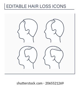 Hair loss line icons set. Classification for baldness in man. Treatment and care. Alopecia concept. Isolated vector illustration. Editable stroke