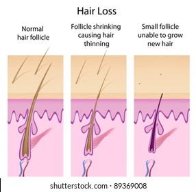 3,718 Cross section of hair Images, Stock Photos & Vectors | Shutterstock