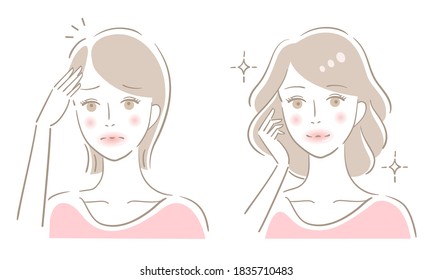 Hair Parting Thinning Woman Before After Illustration. Beauty Hair Care Concept