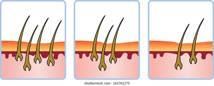 Hair Regrowth Cycle