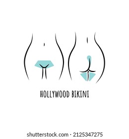 Hair removal bikini area line art. Hollywood bikini scheme. Vector