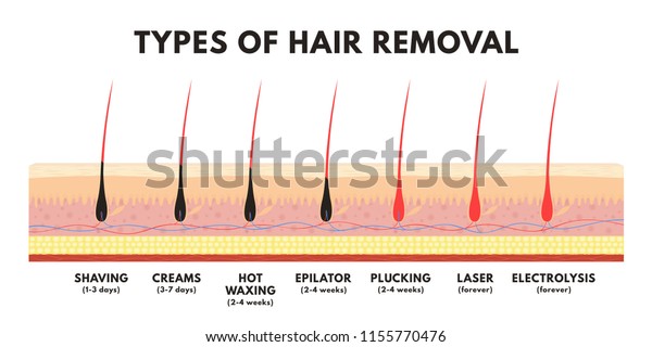 Hair Removal Concept Shaving Depilation Cream Stock Vector