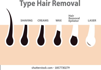 Hair removal concept, types of hair removal. Shaving, depilation cream, waxing, epilator, plucking, laser hair removal. Vector