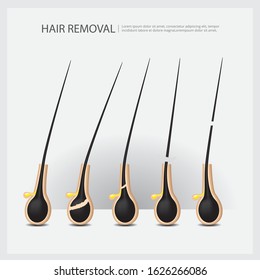 Hair Removal Example Vector Illustration