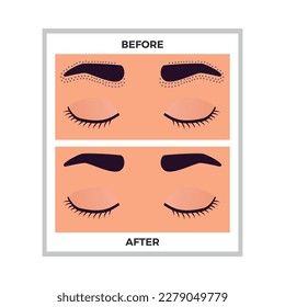 Hair removal eyebrows area before and after flat vector illustration