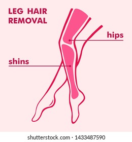 Hair removal from the hips and shins. Depilation zones of the legs. Wax, sugar and laser hair removal of the female body. Flat style. Illustration for beauty salons. 