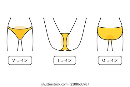 Hair Removal Illustrations for Women VIO - Translation: V-Line, I-Line, O-Line