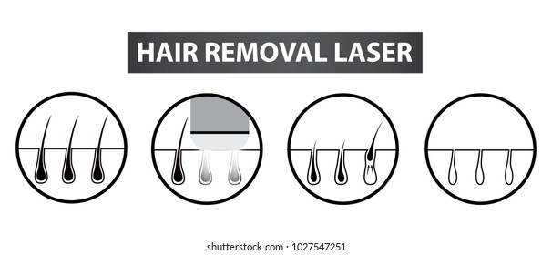 Hair Removal Laser Icon Step Vector Illustration