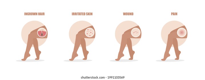 Hair removal problems. Ingrowing hair, irritated skin, wound and pain after epilation. Female legs. Skin care. Vector illustration in flat cartoon style.