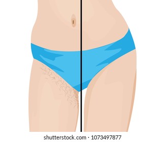 Hair removal results vector illustration