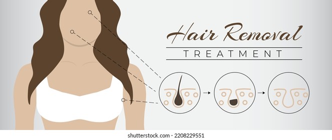 Hair Removal Treatment Banner Illustration Background with Woman