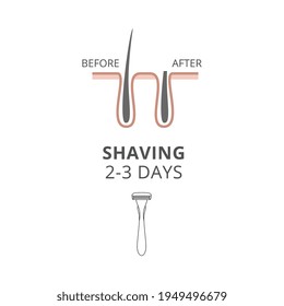 Eliminación del pelo mediante afeitado de la navaja antes y después de una ilustración vectorial.